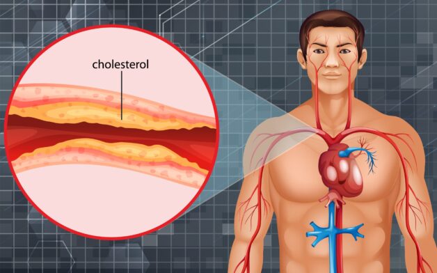 Triệu chứng thiếu máu cục bộ cơ tim cần lưu ý