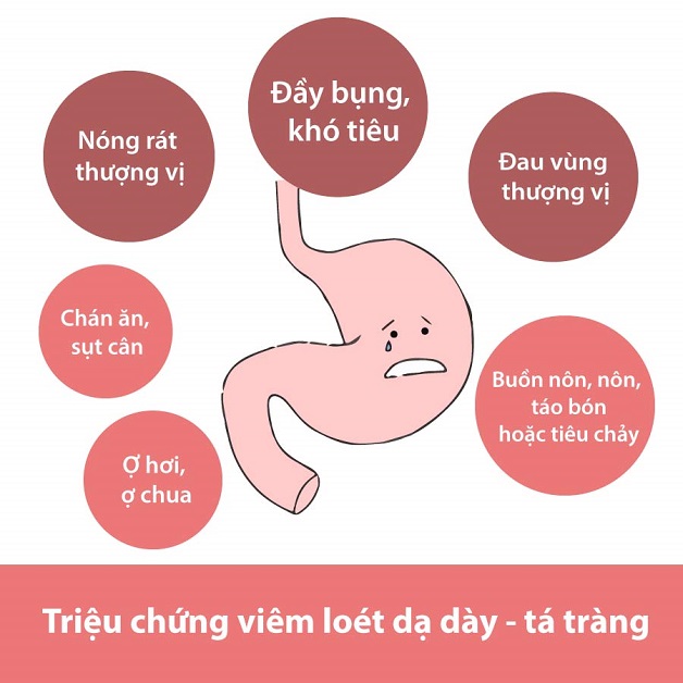 Triệu chứng viêm dạ dày: Nhận biết và chẩn đoán đúng bệnh 