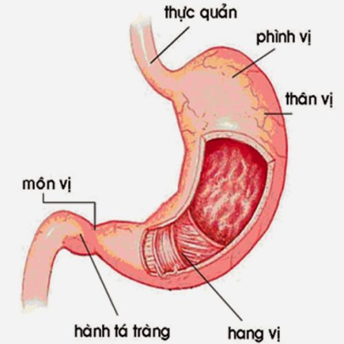 Triệu chứng viêm xung huyết hang vị dạ dày