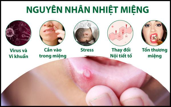 Tư vấn dùng thuốc chữa nhiệt miệng