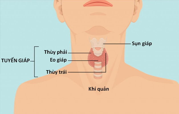 Tuyến giáp to cảnh báo bệnh lý quan trọng