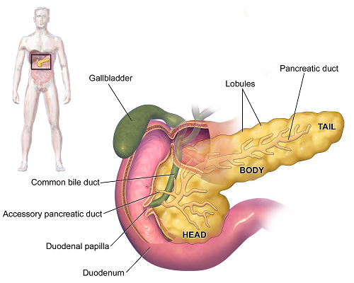 U đầu tụy có nguy hiểm không?