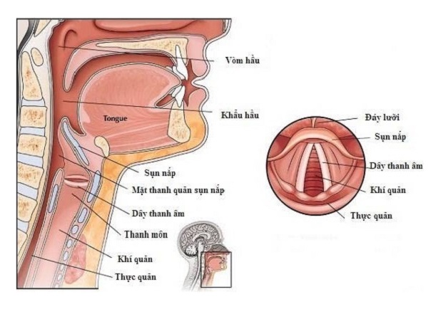 U nang thanh quản là bệnh gì?