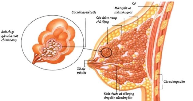 U nang tuyến vú là gì? Dấu hiệu nhận biết và cách điều trị