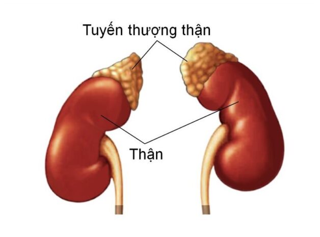 U tuyến thượng thận là gì và những điều cần biết