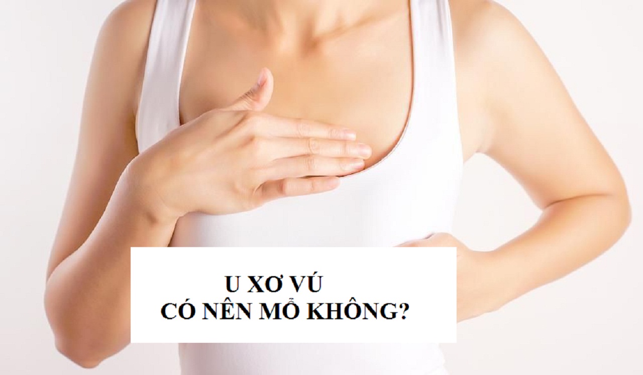 U xơ vú có nên mổ không và mổ bằng phương pháp nào?