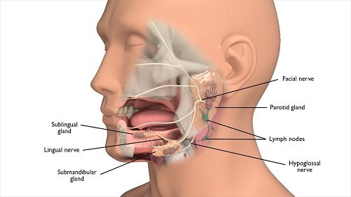 Ung thư tuyến nước bọt do nguyên nhân nào?