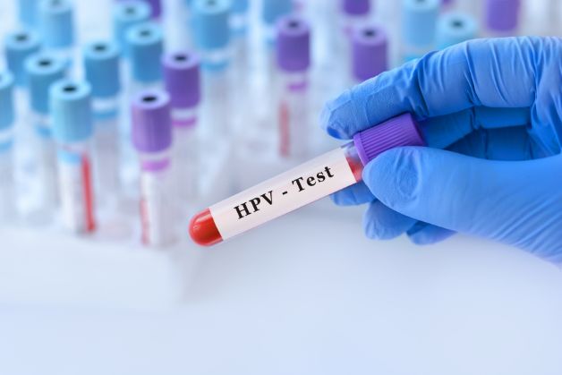 Vai trò của xét nghiệm virus HPV trong tầm soát ung thư cổ tử cung