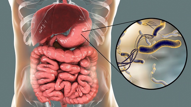 Vi khuẩn HP là gì: Mức độ nguy hiểm, chẩn đoán và điều trị