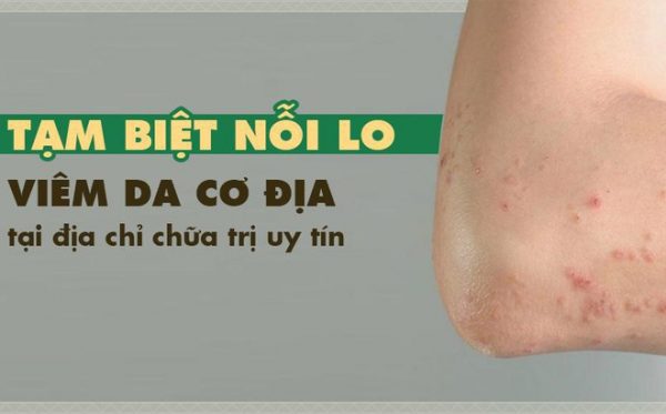 Vì sao viêm da cơ địa dễ tái phát khi trời lạnh?