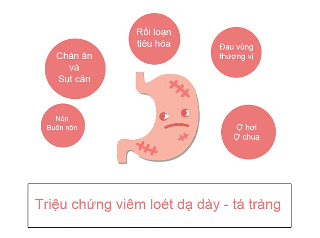 Viêm dạ dày triệu chứng và các kiến thức cơ bản