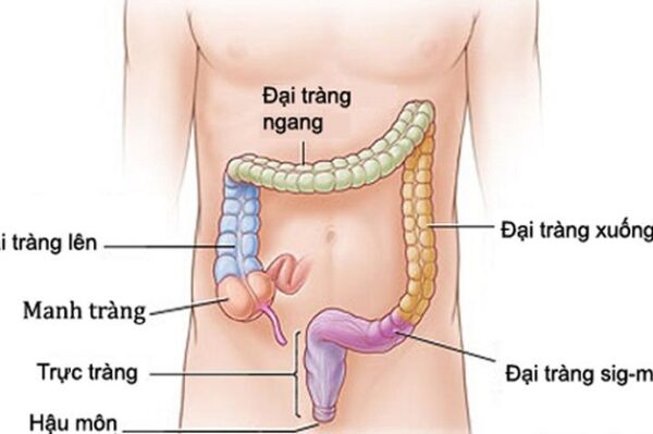 Viêm đại tràng và các nguyên nhân gây viêm đại tràng