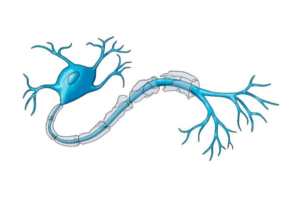 Viêm dây thần kinh thị giác: Nguyên nhân, dấu hiệu, cách điều trị