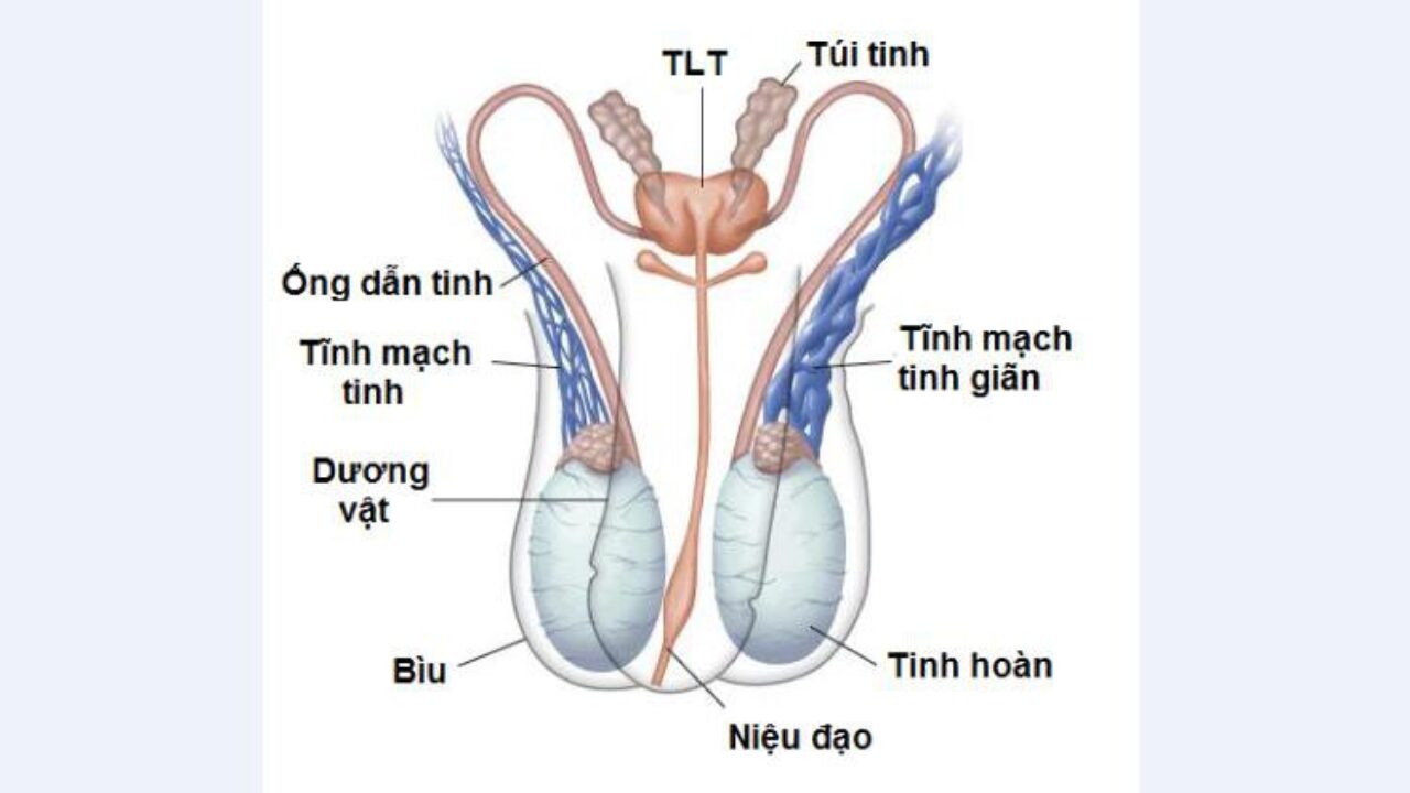 Viêm dây thừng tinh: Nguyên nhân, triệu chứng và cách điều trị