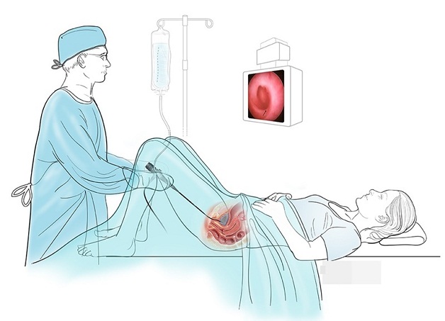 Viêm đường tiết niệu cần xét nghiệm gì?