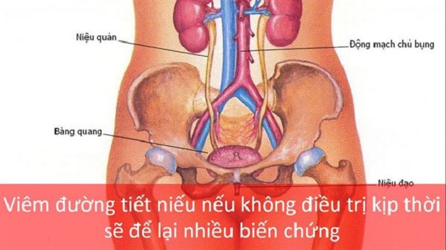 Viêm đường tiết niệu khám ở khoa nào?