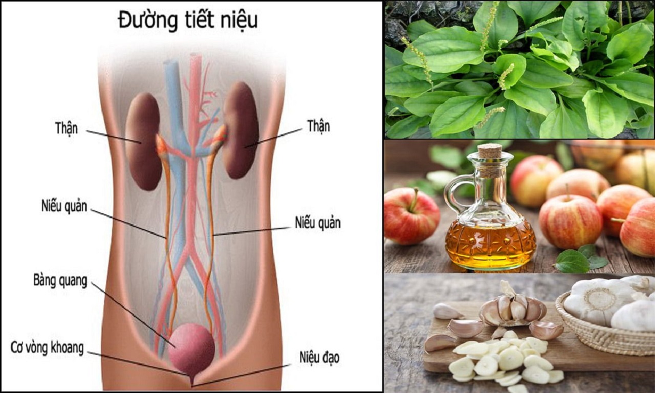 Viêm đường tiết niệu ở nam giới phải làm sao?