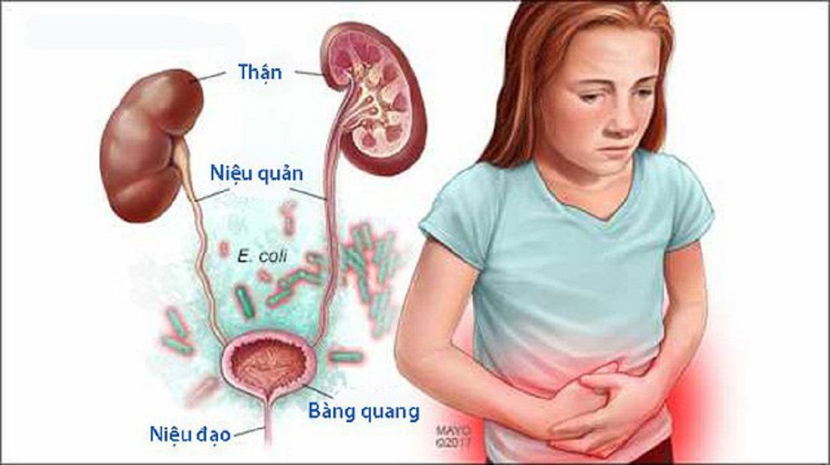 Viêm đường tiết niệu ở trẻ em có nguy hiểm không?