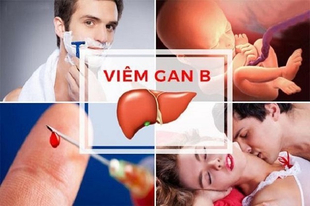 Viêm gan B lây như thế nào và cách phòng tránh