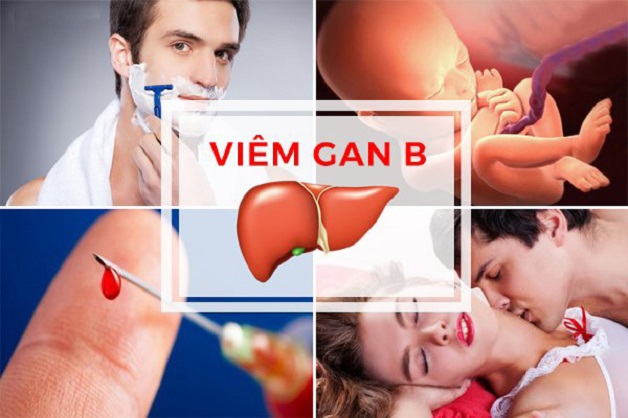 Viêm gan B lây qua những con đường nào- Cách đề phòng