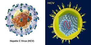 Viêm gan C có lây truyền không? Bệnh tiến triển