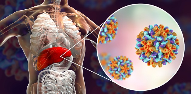Viêm gan siêu vi B mạn là gì? Có nguy hiểm không?