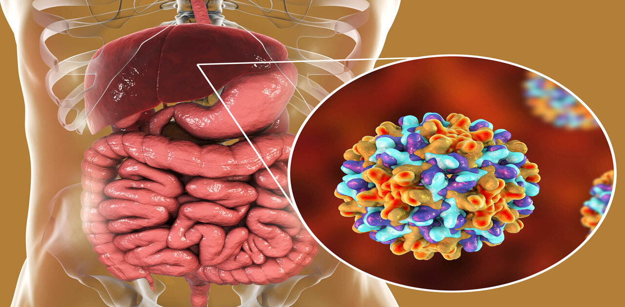 Viêm gan virus cấp: Định nghĩa, chẩn đoán và biện pháp điều trị