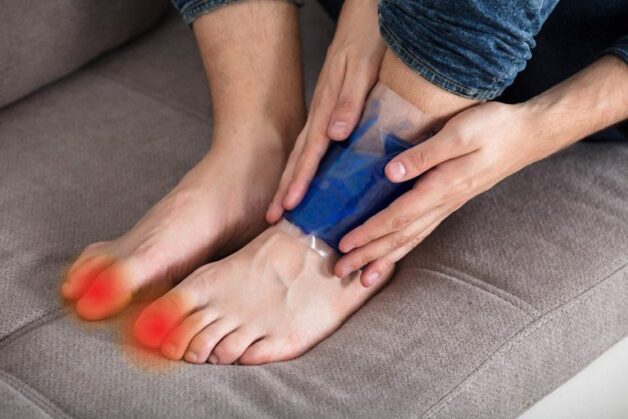 Viêm gout cấp tính và những điều cần biết