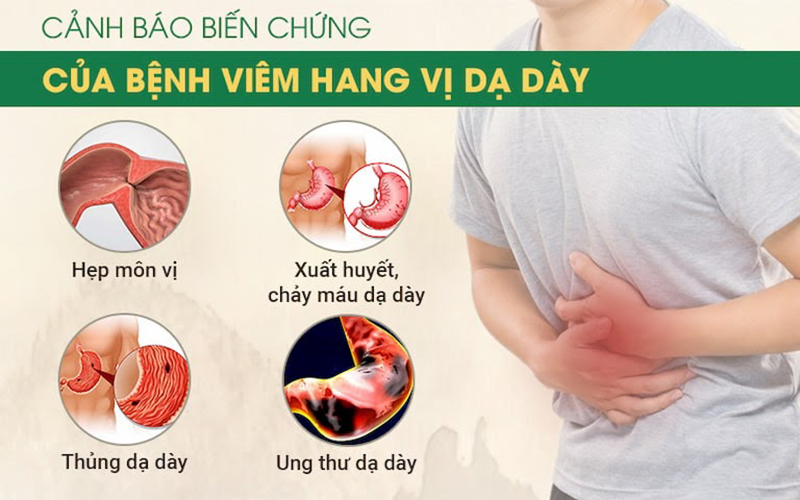 Viêm hang vị và tất cả những điều bạn cần biết