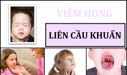 Viêm họng liên cầu khuẩn và những biến chứng