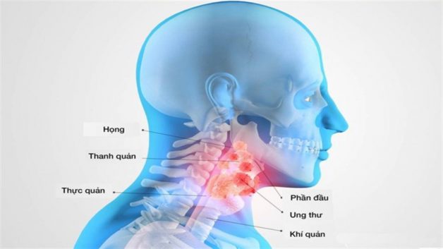 Viêm họng nổi hạch và những điều cần biết