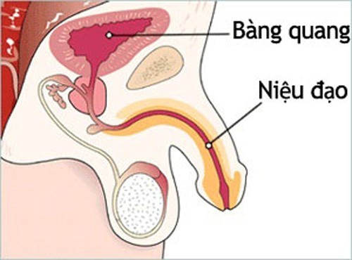 Viêm niệu đạo ở nam giới cần quan tâm đúng cách