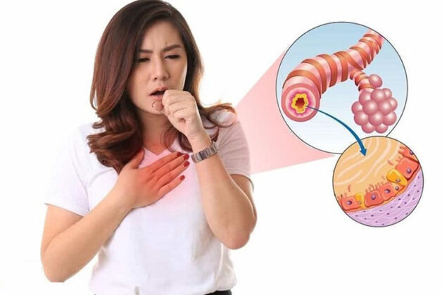 Viêm phế quản ở người lớn: Nguyên nhân, cách điều trị