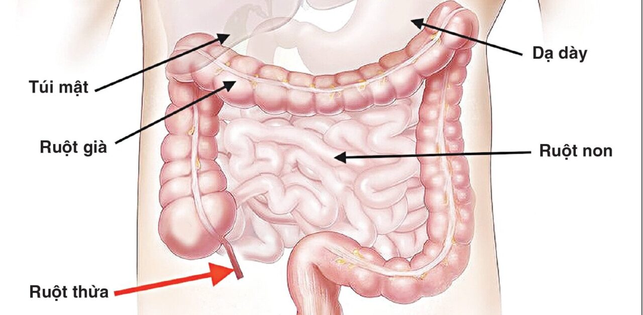 Viêm ruột thừa – nguyên nhân, dấu hiệu và cách phòng ngừa