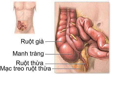 Viêm ruột thừa và những câu hỏi thường gặp