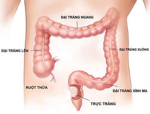 Viêm trực tràng có nguy hiểm không?