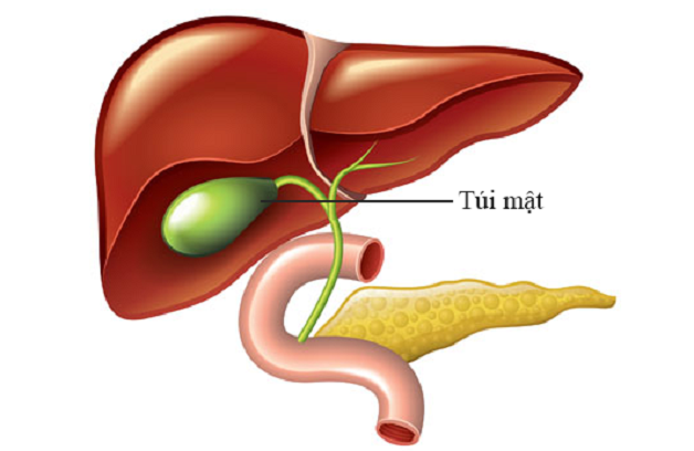 Viêm túi mật: Định nghĩa, nguyên nhân, triệu chứng và cách phòng bệnh 