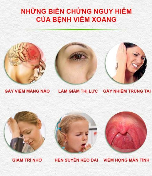 Viêm xoang cấp có nguy hiểm không và khi nào nguy hiểm?