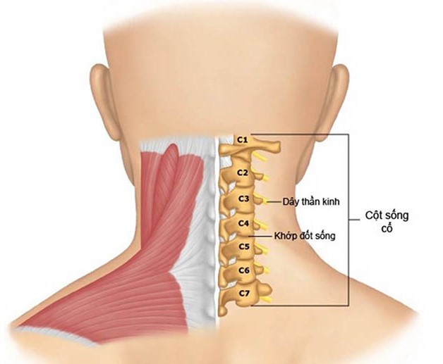 Vôi hóa đốt sống cổ: Nguyên nhân và cách điều trị hiệu quả