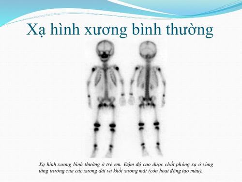 Xạ Hình Xương là gì? Được thực hiện thế nào? Có Nguy hiểm không?