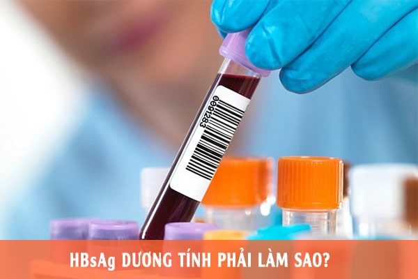 Xét nghiệm chẩn đoán viêm gan B gồm những gì?