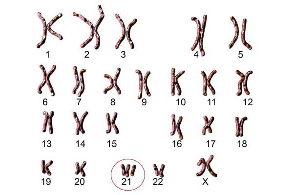 Xét nghiệm Double test sàng lọc trước sinh