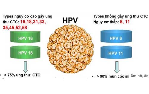 Xét nghiệm HPV là gì? Những ai cần tiến hành xét nghiệm