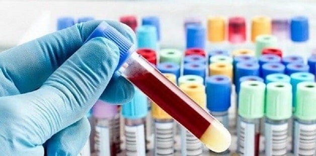 Xét nghiệm sàng lọc trước sinh Double Test và kiến thức mẹ nên biết