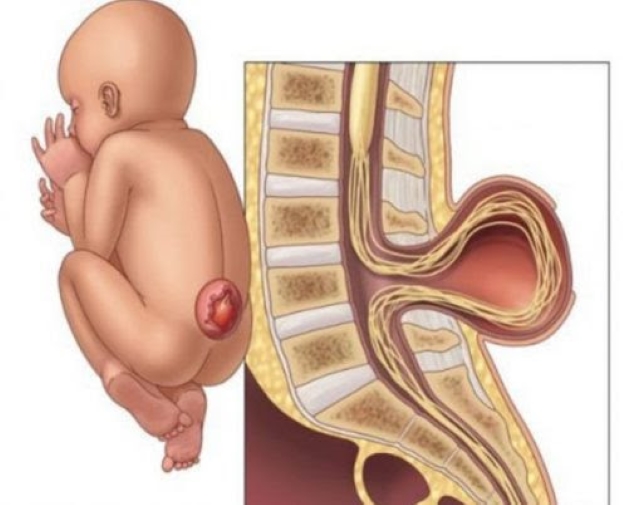 Xét nghiệm sàng lọc và những dị tật thai nhi có thể mắc phải