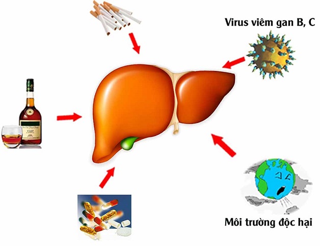 Xơ gan có phục hồi được không và những điều bạn cần biết