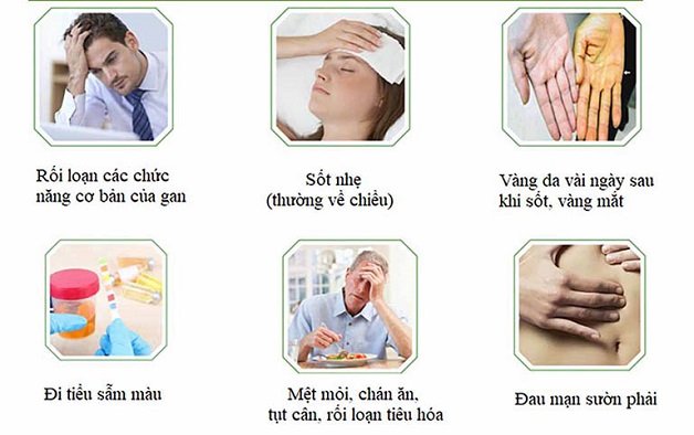 Xơ gan triệu chứng: Nguyên nhân, các giai đoạn và biến chứng