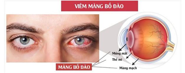 Xuất huyết đại tràng: Cảnh báo các biến chứng nguy hiểm