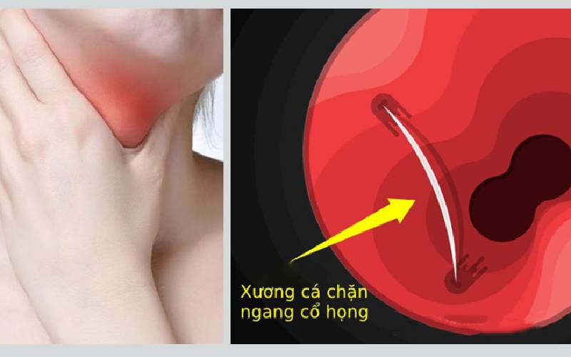 Xương cá có tự tiêu không – Đây là câu trả lời